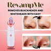 Ultimate Blackhead Remover for Clear - For Radiant Skin!